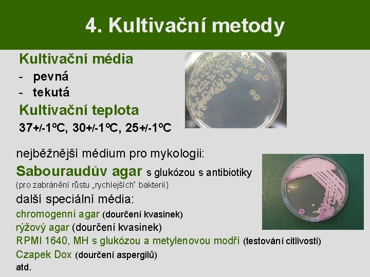 4. Kultivační metody Kultivační média - pevná - tekutá Kultivační teplota 37+/-1ºC, 30+/-1ºC, 25+/-1ºC