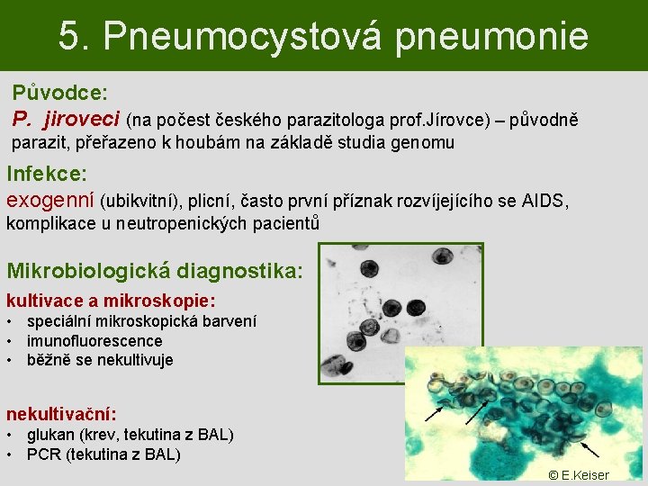 5. Pneumocystová pneumonie Původce: P. jiroveci (na počest českého parazitologa prof. Jírovce) – původně