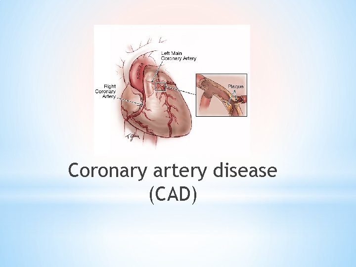 Coronary artery disease (CAD) 