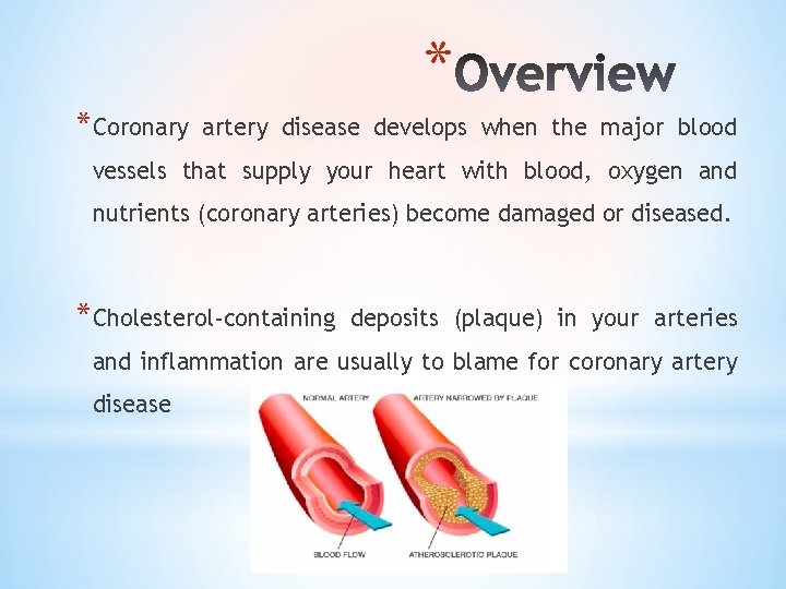 * *Coronary artery disease develops when the major blood vessels that supply your heart