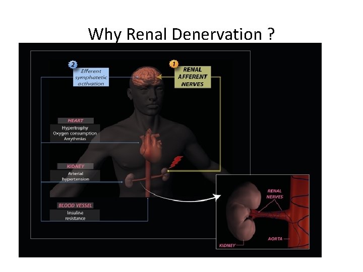 Why Renal Denervation ? 