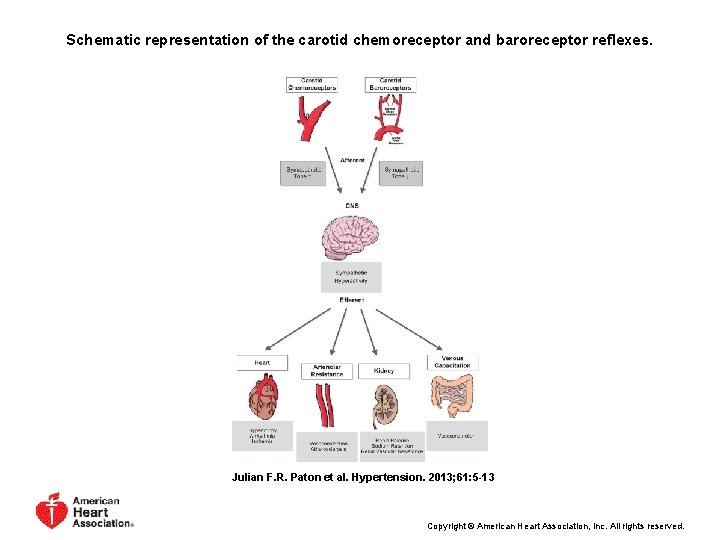 Schematic representation of the carotid chemoreceptor and baroreceptor reflexes. Julian F. R. Paton et