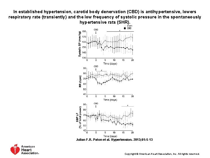 In established hypertension, carotid body denervation (CBD) is antihypertensive, lowers respiratory rate (transiently) and