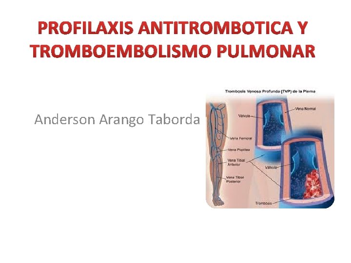 PROFILAXIS ANTITROMBOTICA Y TROMBOEMBOLISMO PULMONAR Anderson Arango Taborda 