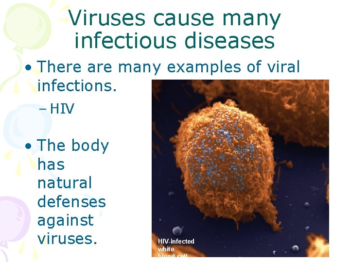 Viruses cause many infectious diseases • There are many examples of viral infections. –