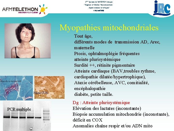 3èmes Journées de RéFLEXION clinique “Urgences & Maladies Neuromusculaires : Aspects médicaux et éthiques”