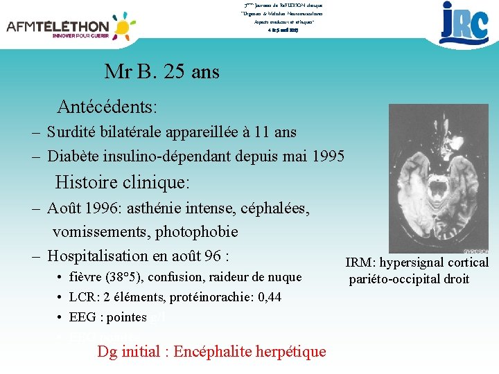 3èmes Journées de RéFLEXION clinique “Urgences & Maladies Neuromusculaires : Aspects médicaux et éthiques”