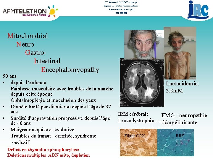 3èmes Journées de RéFLEXION clinique “Urgences & Maladies Neuromusculaires : Aspects médicaux et éthiques”