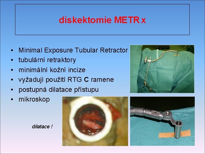 diskektomie METR x • • • Minimal Exposure Tubular Retractor tubulární retraktory minimální kožní
