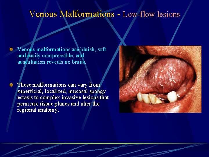 Venous Malformations - Low-flow lesions Venous malformations are bluish, soft and easily compressible, and