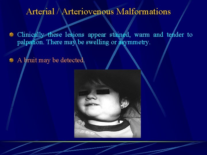 Arterial / Arteriovenous Malformations Clinically these lesions appear stained, warm and tender to palpation.