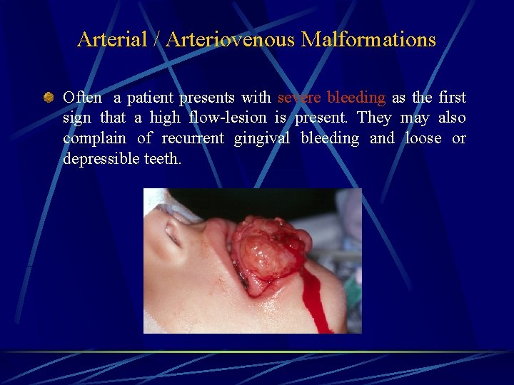 Arterial / Arteriovenous Malformations Often a patient presents with severe bleeding as the first