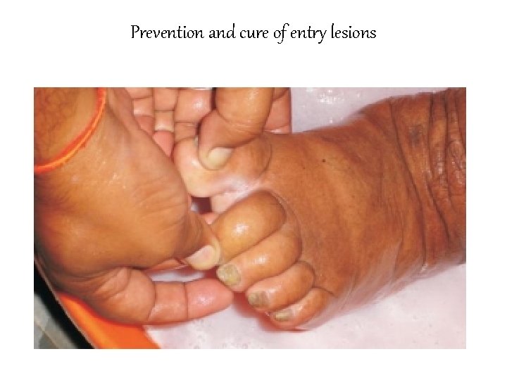 Prevention and cure of entry lesions 