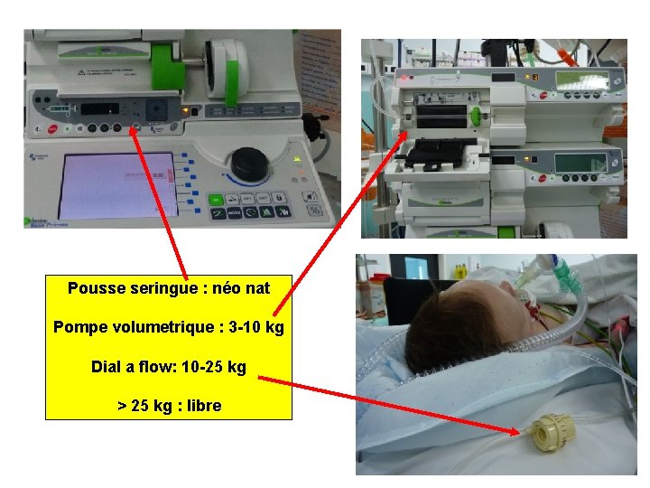 Pousse seringue : néo nat Pompe volumetrique : 3 -10 kg Dial a flow: