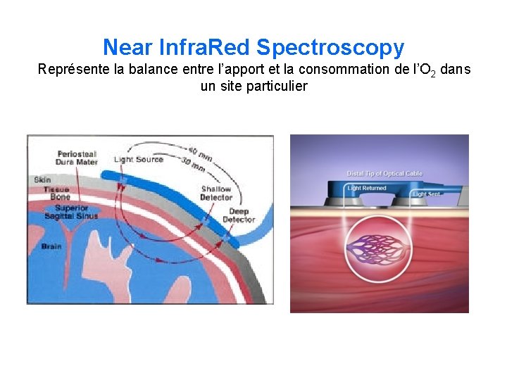 Near Infra. Red Spectroscopy Représente la balance entre l’apport et la consommation de l’O