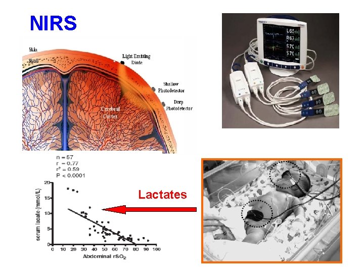 NIRS Lactates 