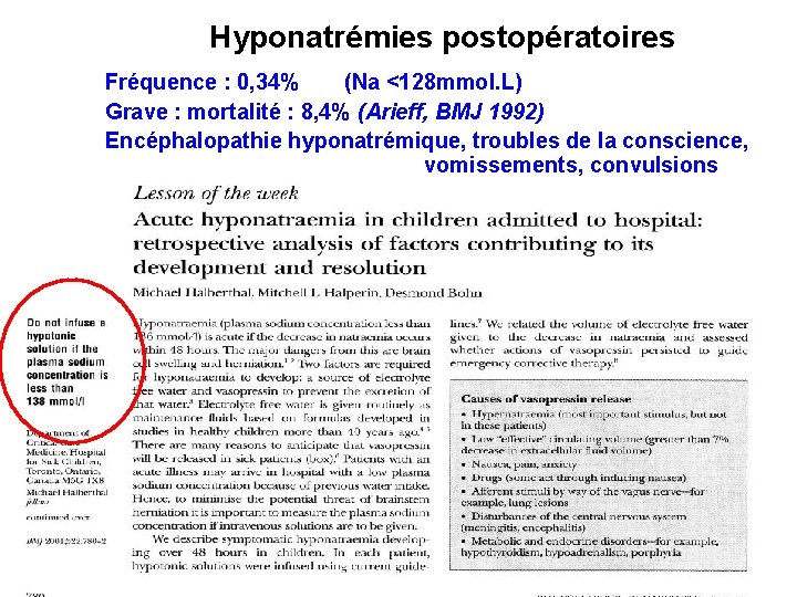 Hyponatrémies postopératoires Fréquence : 0, 34% (Na <128 mmol. L) Grave : mortalité :