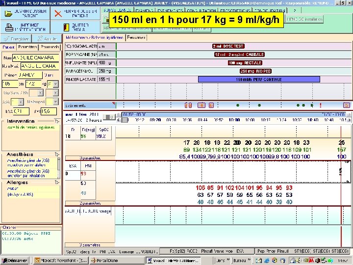 150 ml en 1 h pour 17 kg = 9 ml/kg/h 