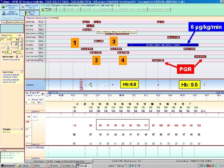 6 µg/kg/min 3 1 2 4 PGR Hb: 6. 8 Hb: 9. 5 