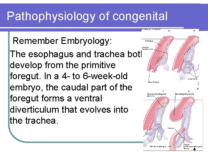 Pathophysiology of congenital Remember Embryology: The esophagus and trachea both develop from the primitive