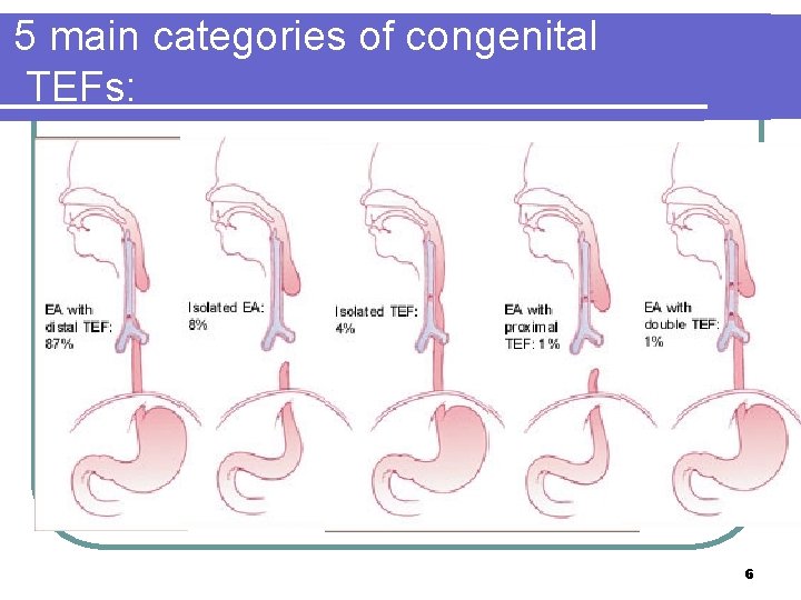 5 main categories of congenital TEFs: 6 