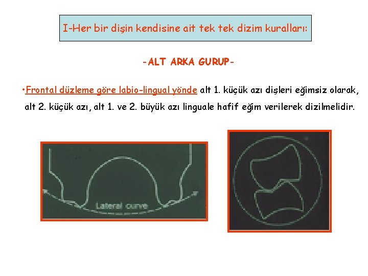 I-Her bir dişin kendisine ait tek dizim kuralları: -ALT ARKA GURUP- • Frontal düzleme I-Her bir dişin kendisine ait tek dizim kuralları: -ALT ARKA GURUP- • Frontal düzleme