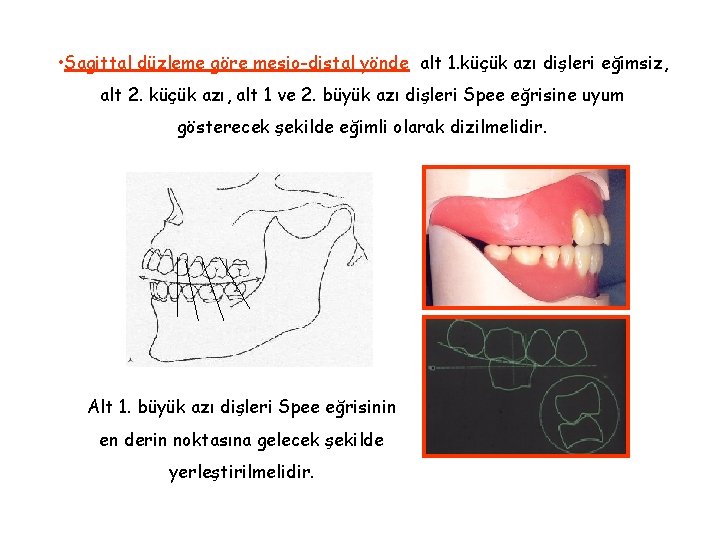 • Sagittal düzleme göre mesio-distal yönde alt 1. küçük azı dişleri eğimsiz, alt • Sagittal düzleme göre mesio-distal yönde alt 1. küçük azı dişleri eğimsiz, alt