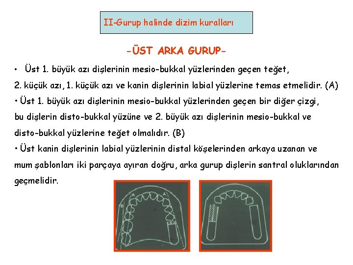 II-Gurup halinde dizim kuralları -ÜST ARKA GURUP • Üst 1. büyük azı dişlerinin mesio-bukkal II-Gurup halinde dizim kuralları -ÜST ARKA GURUP • Üst 1. büyük azı dişlerinin mesio-bukkal