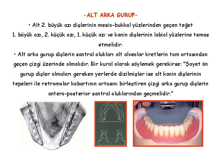 -ALT ARKA GURUP- • Alt 2. büyük azı dişlerinin mesio-bukkal yüzlerinden geçen teğet 1. -ALT ARKA GURUP- • Alt 2. büyük azı dişlerinin mesio-bukkal yüzlerinden geçen teğet 1.