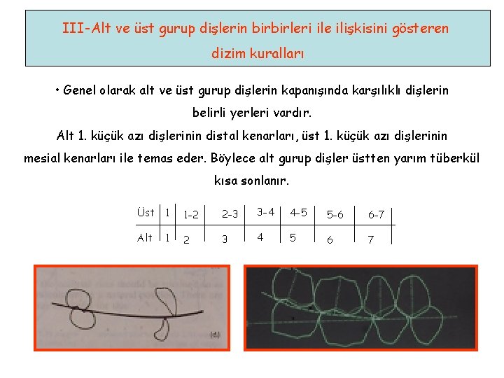 III-Alt ve üst gurup dişlerin birbirleri ile ilişkisini gösteren dizim kuralları • Genel olarak III-Alt ve üst gurup dişlerin birbirleri ile ilişkisini gösteren dizim kuralları • Genel olarak