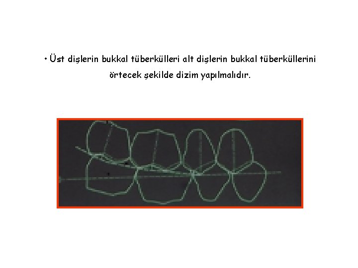 • Üst dişlerin bukkal tüberkülleri alt dişlerin bukkal tüberküllerini örtecek şekilde dizim yapılmalıdır. • Üst dişlerin bukkal tüberkülleri alt dişlerin bukkal tüberküllerini örtecek şekilde dizim yapılmalıdır.