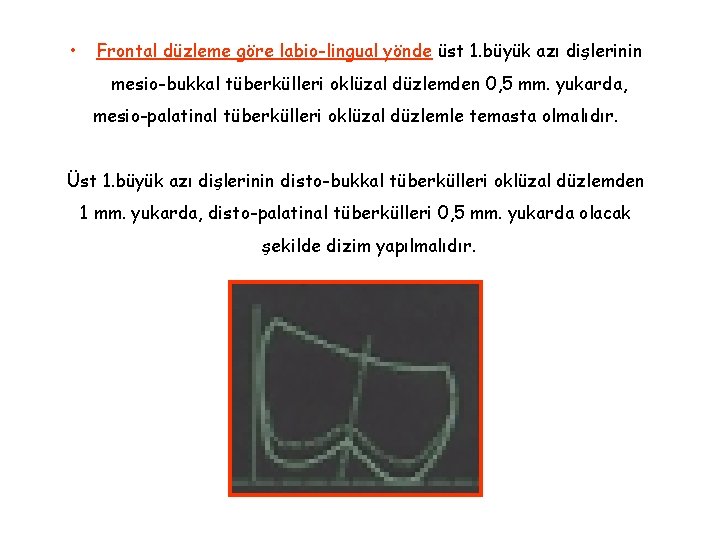 • Frontal düzleme göre labio-lingual yönde üst 1. büyük azı dişlerinin mesio-bukkal tüberkülleri • Frontal düzleme göre labio-lingual yönde üst 1. büyük azı dişlerinin mesio-bukkal tüberkülleri