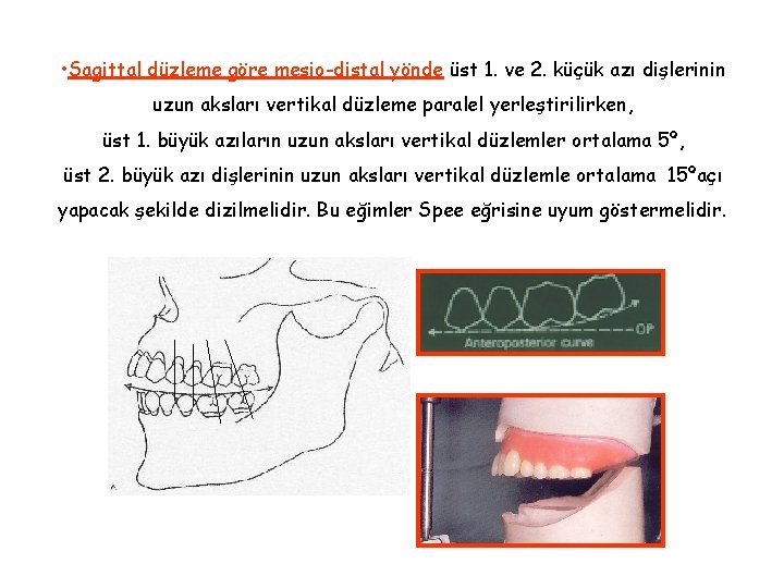 • Sagittal düzleme göre mesio-distal yönde üst 1. ve 2. küçük azı dişlerinin • Sagittal düzleme göre mesio-distal yönde üst 1. ve 2. küçük azı dişlerinin