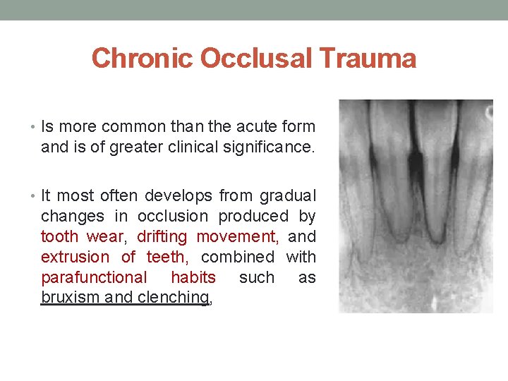 Chronic Occlusal Trauma • Is more common than the acute form and is of