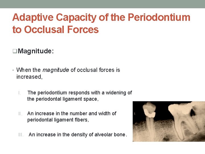 Adaptive Capacity of the Periodontium to Occlusal Forces q. Magnitude: • When the magnitude