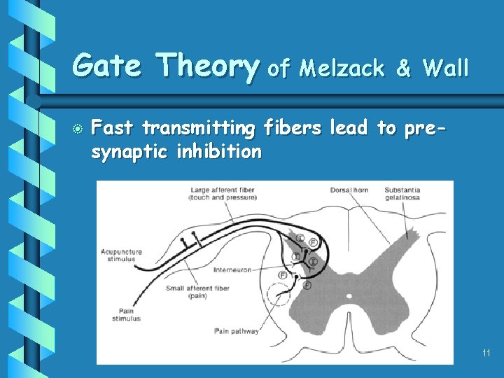 Gate Theory of Melzack b & Wall Fast transmitting fibers lead to presynaptic inhibition