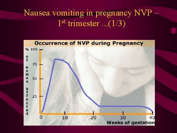 Nausea vomiting in pregnancy NVP – 1 st trimester. . . (1/3) 