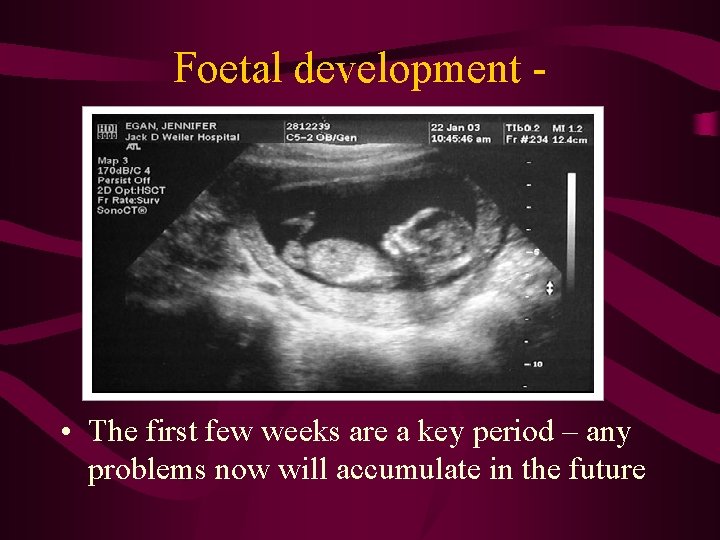 Foetal development - • The first few weeks are a key period – any