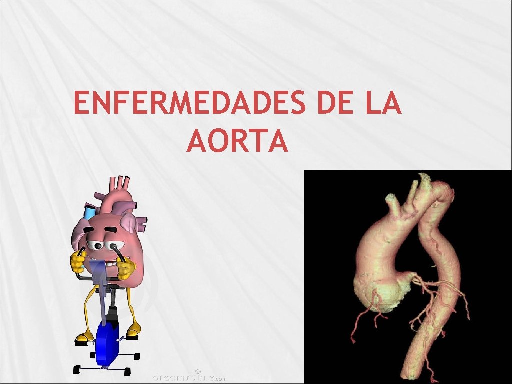 ENFERMEDADES DE LA AORTA 