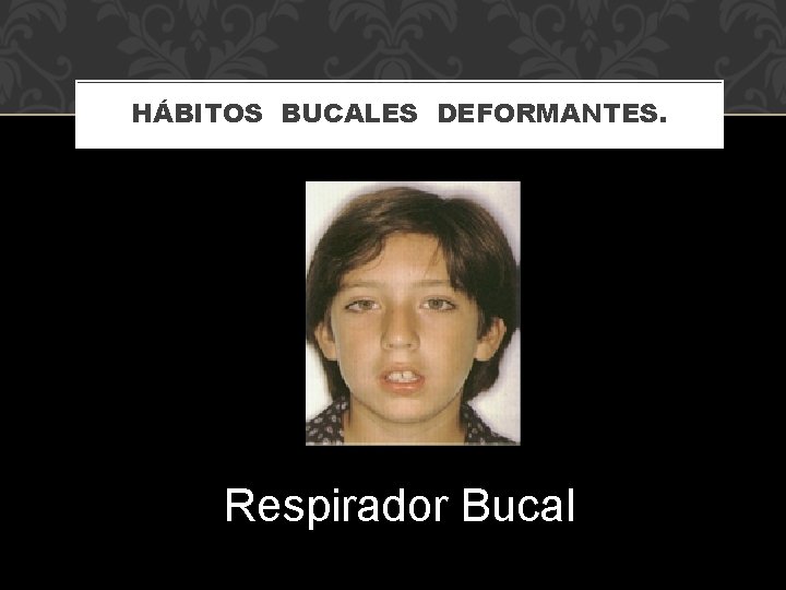 HÁBITOS BUCALES DEFORMANTES. Respirador Bucal 