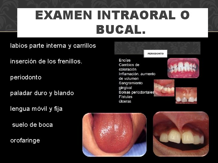 EXAMEN INTRAORAL O BUCAL. labios parte interna y carrillos inserción de los frenillos. periodonto