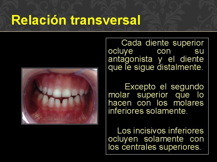 Relación transversal Cada diente superior ocluye con su antagonista y el diente que le