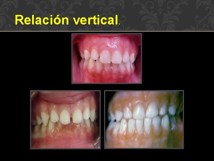 Relación vertical. 