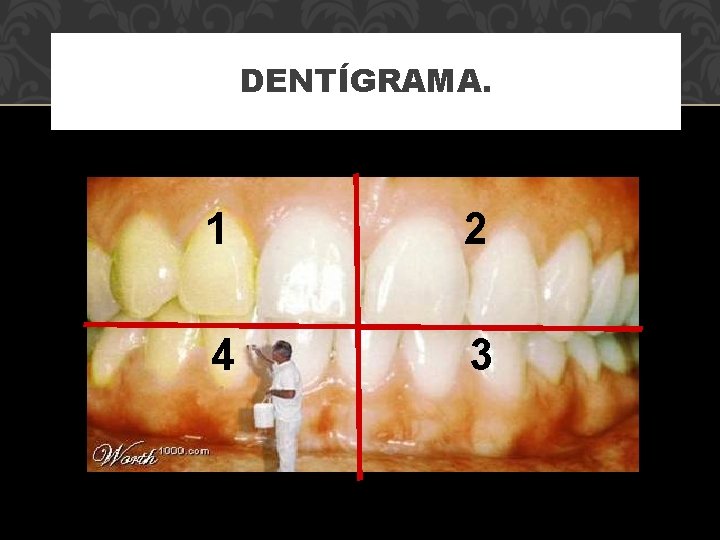 DENTÍGRAMA. 1 2 4 3 