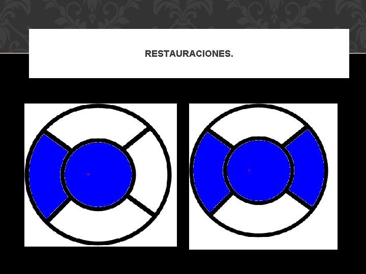RESTAURACIONES. 