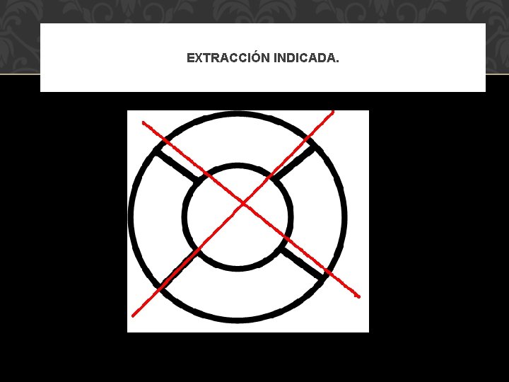 EXTRACCIÓN INDICADA. 