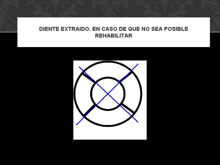 DIENTE EXTRAIDO. EN CASO DE QUE NO SEA POSIBLE REHABILITAR 