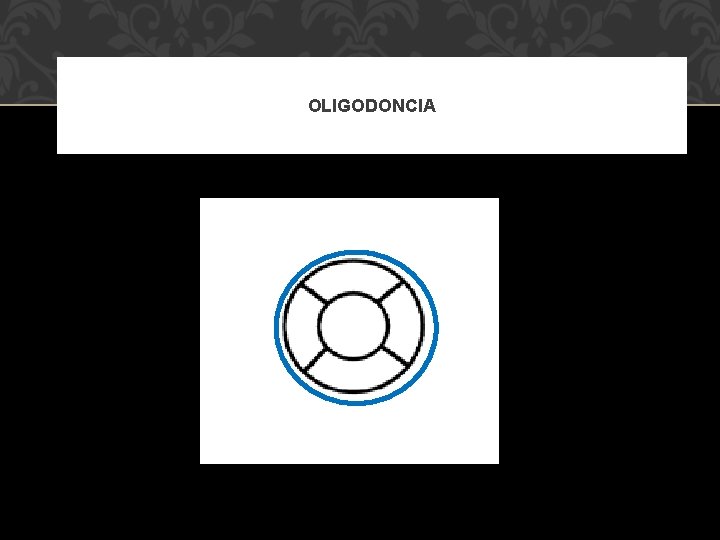 OLIGODONCIA 