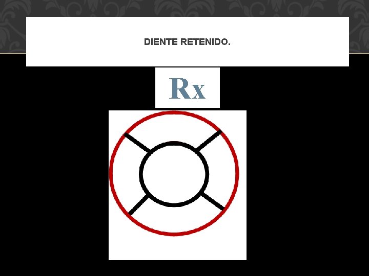 DIENTE RETENIDO. Rx 
