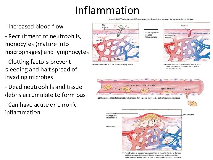 Inflammation ‐ Increased blood flow ‐ Recruitment of neutrophils, monocytes (mature into macrophages) and